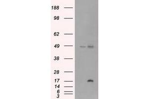 Image no. 1 for anti-Cancer/testis Antigen 1B (CTAG1B) antibody (ABIN1499904) (CTAG1B antibody)