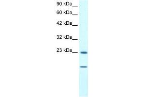 WB Suggested Anti-HSPB1 Antibody Titration:  1. (HSP27 antibody  (C-Term))
