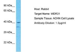 Host: Rabbit Target Name: WDR31 Sample Tissue: Human ACHN Whole Cell  Antibody Dilution: 1ug/ml (WDR31 antibody  (Middle Region))