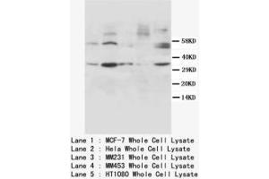 Image no. 1 for anti-Cyclin D1 (CCND1) (N-Term) antibody (ABIN1495167) (Cyclin D1 antibody  (N-Term))