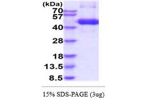 SDS-PAGE (SDS) image for Transforming Growth Factor, beta Receptor 1 (TGFBR1) (AA 27-126) protein (hIgG-His-tag) (ABIN5855082)