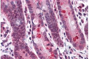 Human Small Intestine: Formalin-Fixed, Paraffin-Embedded (FFPE) (Anoctamin 2 antibody  (N-Term))