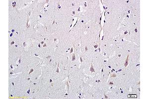 Formalin-fixed and paraffin embedded rat brain labeled with Anti-CD146/MCAM Polyclonal Antibody, Unconjugated (ABIN732143) at 1:400 followed by conjugation to the secondary antibody and DAB staining