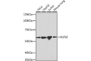 Western blot analysis of extracts of various cell lines, using KLF10 Rabbit mAb (ABIN7268150) at 1:1000 dilution. (KLF10/TIEG1 antibody)