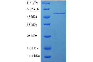 SDS-PAGE (SDS) image for Milk Fat Globule-EGF Factor 8 Protein (MFGE8) (AA 24-387) protein (His-SUMO Tag) (ABIN5709927)