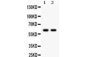 Observed bind size: 61KD (CYP1B1 antibody  (AA 255-480))