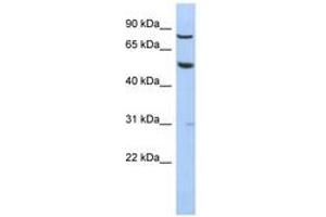 Image no. 1 for anti-G Protein-Coupled Receptor 56 (GPR56) (N-Term) antibody (ABIN6744295) (GPR56 antibody  (N-Term))