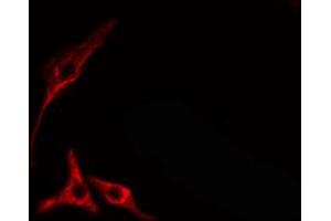 ABIN6274689 staining HepG2 cells by IF/ICC. (Laminin beta 1 antibody  (C-Term))
