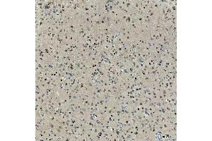 IHC analysis of SNRNP27 using anti-SNRNP27 antibody (ABIN7599614). (SNRNP27 antibody  (AA 100-155))