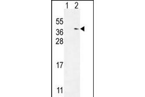 Western blot analysis of TXNDC6 (arrow) using rabbit polyclonal TXNDC6 Antibody (Center) (ABIN654968 and ABIN2844606). (NME9 antibody  (AA 111-139))