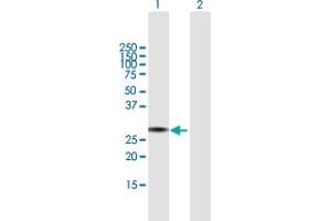 Western Blot analysis of TRIM72 expression in transfected 293T cell line by TRIM72 MaxPab polyclonal antibody. (TRIM72 antibody  (AA 1-269))