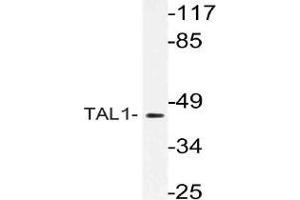 Western blot analysis of TAL1 Antibody in extracts from Jurkat cells. (TAL1 antibody)