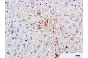 Formalin-fixed and paraffin embedded mouse liver labeled with Rabbit Anti phospho-GCN2 (Thr667) Polyclonal Antibody, Unconjugated  at 1:200 followed by conjugation to the secondary antibody and DAB staining (GCN2 antibody  (pThr667))