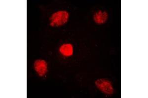 Immunofluorescent analysis of TRAP220 staining in HuvEc cells. (MED1 antibody  (Center))