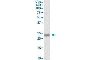 MYL5 monoclonal antibody (M03), clone 3D12. (MYL5 antibody  (AA 4-96))