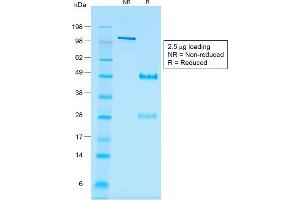 SDS-PAGE (SDS) image for anti-Wilms Tumor 1 (WT1) antibody (ABIN6940904)