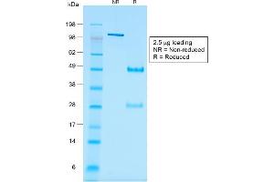 SDS-PAGE Analysis Purified Wilm's Tumor Mouse Recombinant Monoclonal Antibody (rWT1/857). (Recombinant WT1 antibody)
