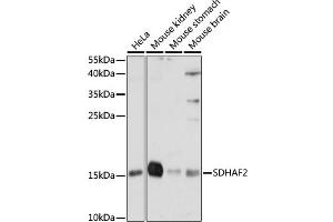 Western blot analysis of extracts of various cell lines, using SDH antibody (ABIN7270619) at 1:1000 dilution. (Sdhaf2 antibody  (AA 1-166))