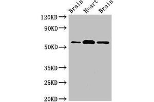 Western Blot Positive WB detected in: Rat brain tissue, Mouse heart tissue, Mouse brain tissue All lanes: ATG14 antibody at 2 μg/mL Secondary Goat polyclonal to rabbit IgG at 1/50000 dilution Predicted band size: 56, 43 kDa Observed band size: 56 kDa (ATG14 antibody  (AA 1-492))