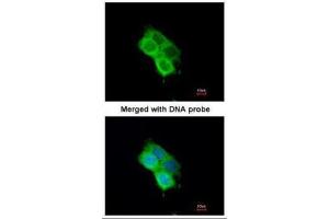ICC/IF Image Immunofluorescence analysis of paraformaldehyde-fixed A431, using OXSR1(OSR1), antibody at 1:200 dilution. (OXSR1 antibody  (Center))