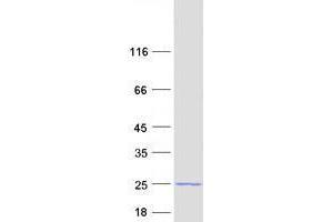 Validation with Western Blot (TMEM31 Protein (Myc-DYKDDDDK Tag))