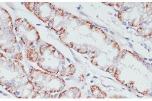 Immunohistochemistry of paraffin-embedded Human stomach using ACSL3 Polyclonal Antibody at dilution of 1:100 (40x lens). (Acsl3 antibody)