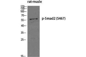 Western Blot (WB) analysis of specific cells using Phospho-Smad2 (S467) Polyclonal Antibody. (SMAD2 antibody  (pSer467))