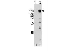 Western blot analysis of FGFR1 (arrow) using rabbit polyclonal FGFR1 Antibody  (R). (FGFR1 antibody  (AA 631-660))