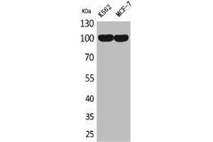 Western Blot analysis of K562 MCF7 cells using CD203c Polyclonal Antibody (ENPP3 antibody  (Internal Region))