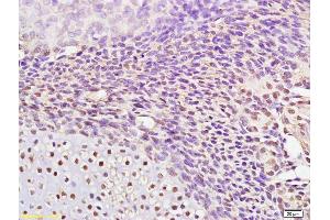 Formalin-fixed and paraffin embedded mouse embryo labeled with Rabbit Anti AP2 gamma Polyclonal Antibody, Unconjugated (ABIN720056) at 1:200 followed by conjugation to the secondary antibody and DAB staining (TFAP2C antibody  (AA 2-100))