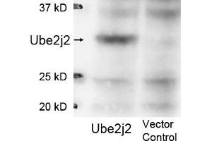 Image no. 1 for anti-Ubiquitin-Conjugating Enzyme E2, J2 (UBE2J2) (Internal Region) antibody (ABIN401475) (UBE2J2 antibody  (Internal Region))