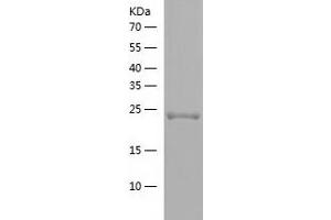 Western Blotting (WB) image for RAB5C, Member RAS Oncogene Family (Rab5c) (AA 1-216) protein (His-IF2DI Tag) (ABIN7124761)