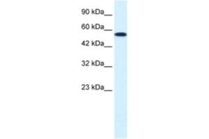 Western Blotting (WB) image for anti-Checkpoint Kinase 1 (CHEK1) antibody (ABIN2460510) (CHEK1 antibody)