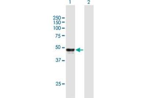 Western Blot analysis of SERPINH1 expression in transfected 293T cell line by SERPINH1 MaxPab polyclonal antibody.
