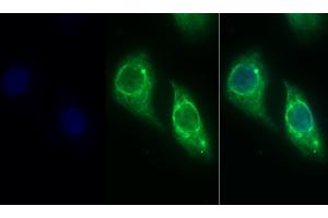Detection of CK19 in Human Hela cell using Monoclonal Antibody to Cytokeratin 19 (CK19) (Cytokeratin 19 antibody  (AA 245-391))