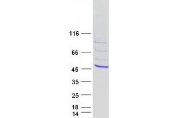 T-Box 10 Protein (TBX10) (Myc-DYKDDDDK Tag)