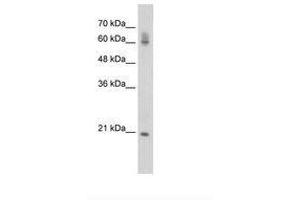 Image no. 1 for anti-FIP1 Like 1 (FIP1L1) (AA 509-558) antibody (ABIN6736286) (FIP1L1 antibody  (AA 509-558))