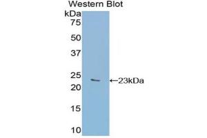 Western blot analysis of the recombinant protein. (GAA antibody  (AA 782-953))