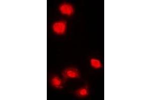 Immunofluorescent analysis of AMPK alpha 1 staining in HeLa cells. (PRKAA1 antibody  (C-Term))