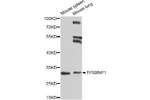 Western blot analysis of extracts of mouse spleen and mouse lung cell lines, using TP53INP1 antibody.