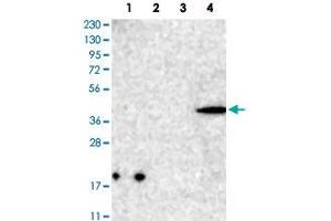 Western Blot analysis of Lane 1: RT-4 cell, Lane 2: U-251 MG sp cell, Lane 3: human plasma tissue (IgG/HSA depleted) and Lane 4: human liver tissue lysates with CNTLN polyclonal antibody . (CNTLN antibody)
