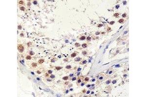 Immunohistochemical analysis of paraffin-embedded human testis using TBP antibody at 1:25 dilution. (TBP antibody)