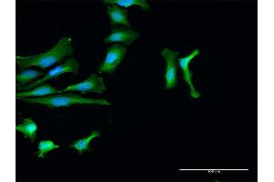 Immunofluorescence of purified MaxPab antibody to PTPN2 on HeLa cell. (PTPN2 antibody  (AA 1-387))