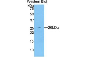 Detection of Recombinant TLR5, Human using Polyclonal Antibody to Toll Like Receptor 5 (TLR5) (TLR5 antibody  (AA 693-858))