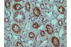 This image was kindly submitted by Horea Rus of the University of Maryland. (RGC32 antibody  (AA 98-137))