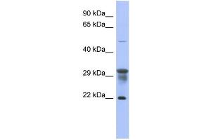 WB Suggested Anti-PMM1 Antibody Titration: 0.