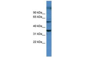 Image no. 1 for anti-Cytochrome P450, Family 11, Subfamily B, Polypeptide 1 (CYP11B1) (AA 202-251) antibody (ABIN6746766)