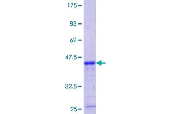LRP3 Protein (AA 671-770) (GST tag)