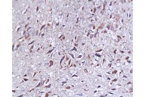 Formalin-fixed and paraffin embedded rat brain tissue labeled with Anti-SYP p38/Synaptophysin/SAP-1 Polyclonal Antibody, Unconjugated  at 1:200, followed by conjugation to the secondary antibody and DAB staining (SYAP1 antibody  (AA 151-230))