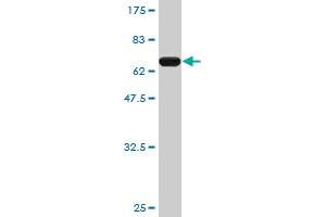 Western Blot detection against Immunogen (65. (PCBP2 antibody  (AA 1-362))